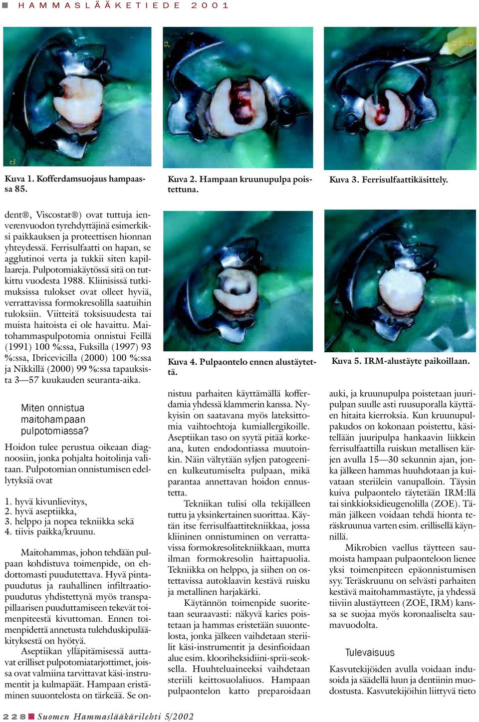Pulpotomiakäytössä sitä on tutkittu vuodesta 1988. Kliinisissä tutkimuksissa tulokset ovat olleet hyviä, verrattavissa formokresolilla saatuihin tuloksiin.