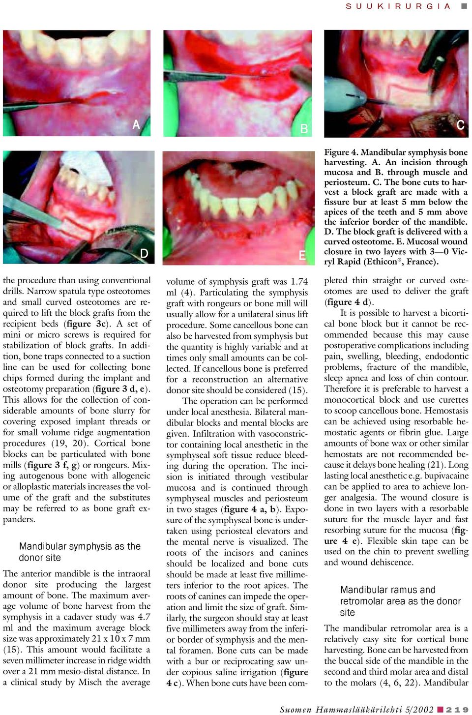 In addition, bone traps connected to a suction line can be used for collecting bone chips formed during the implant and osteotomy preparation (figure 3 d, e).