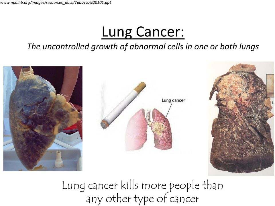 ppt Lung Cancer: The uncontrolled growth of