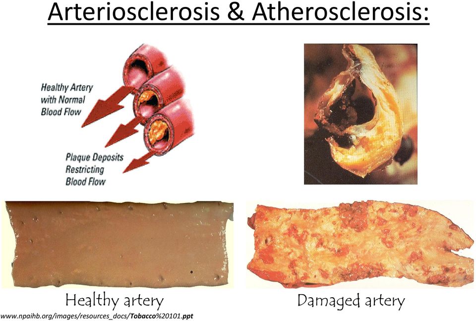 artery www.npaihb.