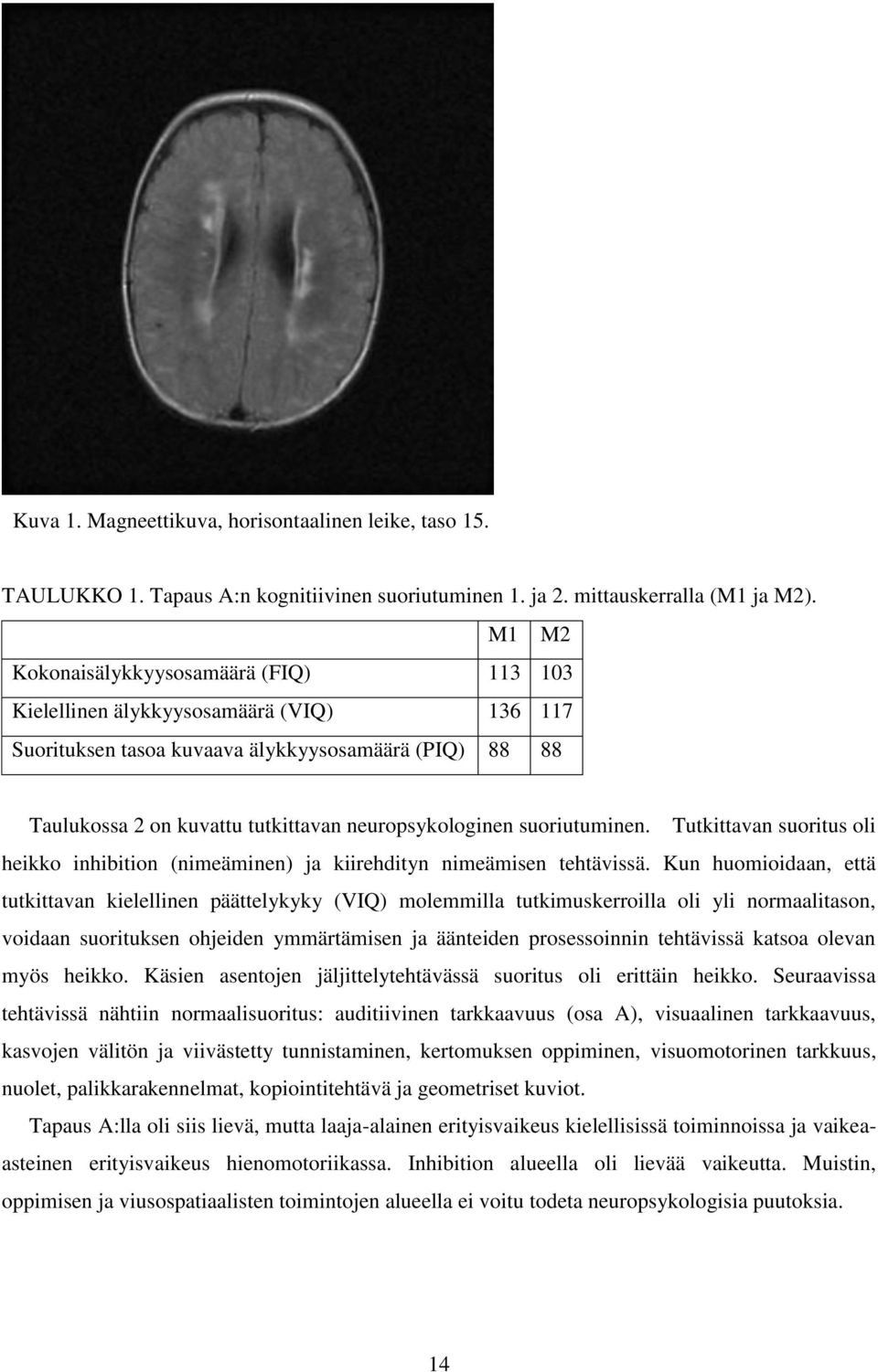 suoriutuminen. Tutkittavan suoritus oli heikko inhibition (nimeäminen) ja kiirehdityn nimeämisen tehtävissä.