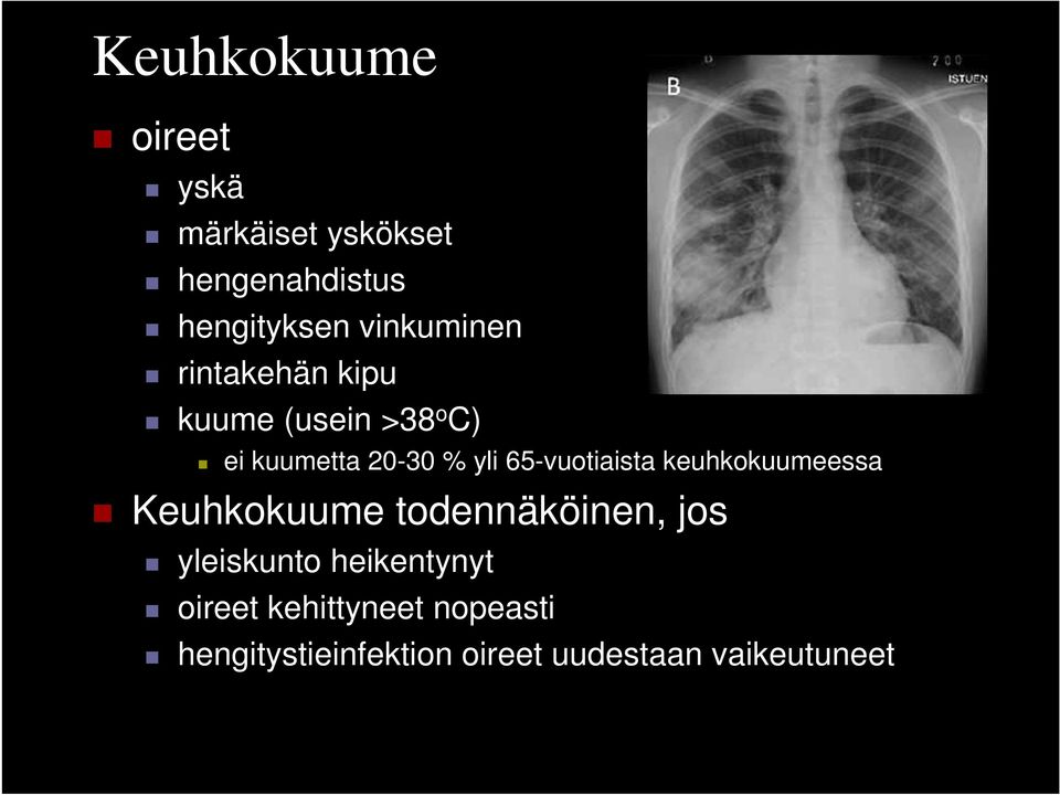 65-vuotiaista keuhkokuumeessa Keuhkokuume todennäköinen, jos yleiskunto