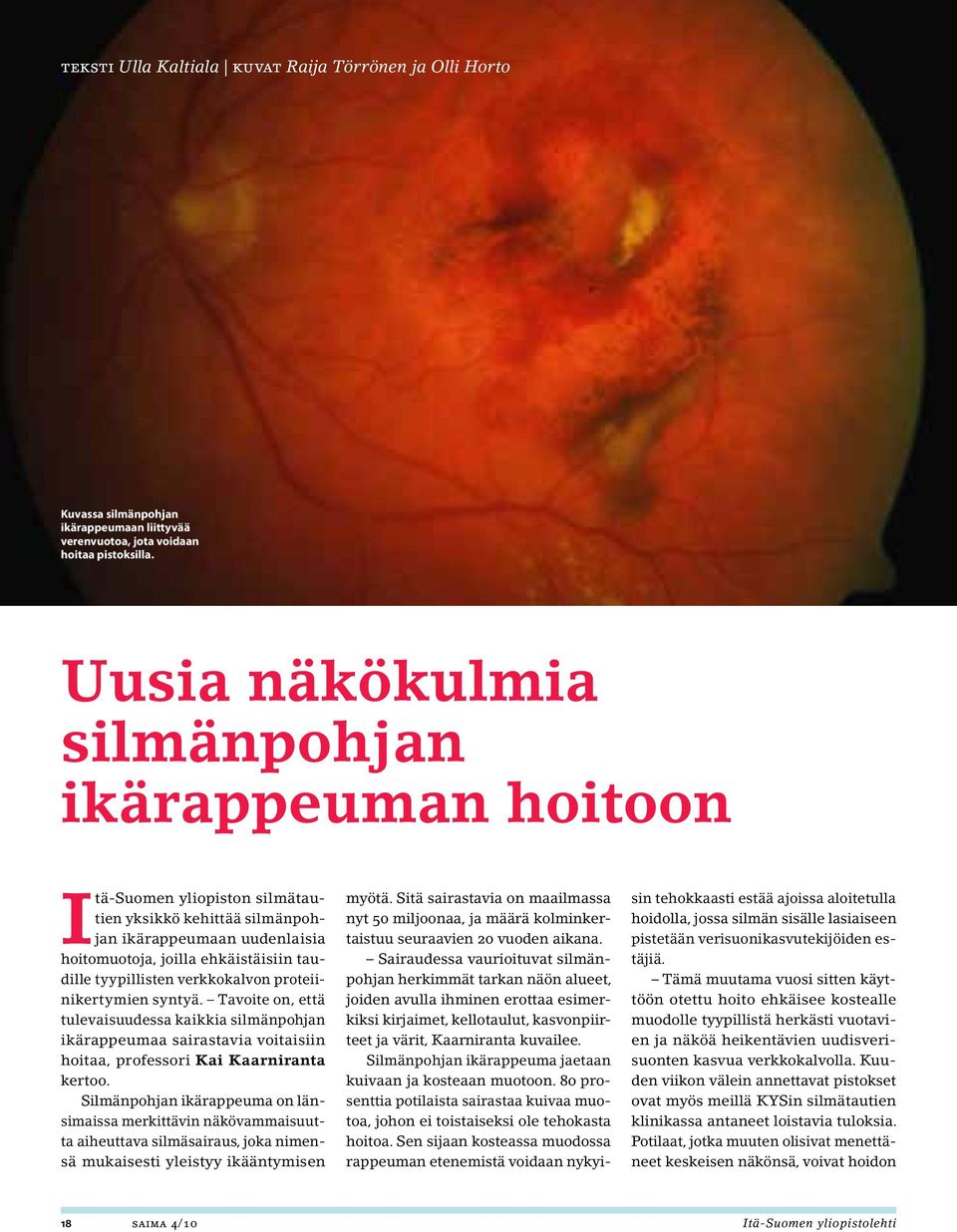 verkkokalvon proteiinikertymien syntyä. Tavoite on, että tulevaisuudessa kaikkia silmänpohjan ikärappeumaa sairastavia voitaisiin hoitaa, professori Kai Kaarniranta kertoo.