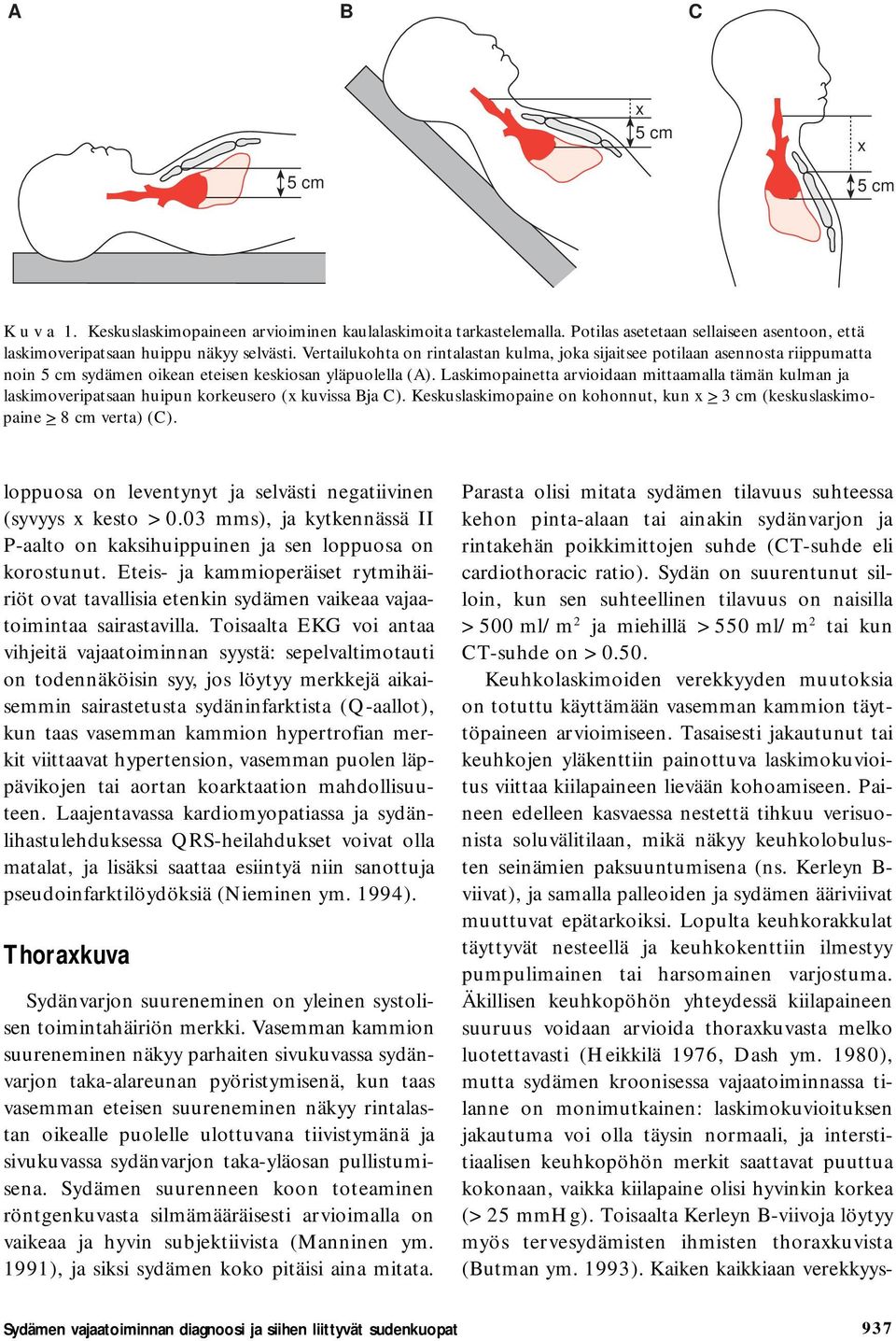 Laskimopainetta arvioidaan mittaamalla tämän kulman ja laskimoveripatsaan huipun korkeusero (x kuvissa Bja C). Keskuslaskimopaine on kohonnut, kun x > 3 cm (keskuslaskimopaine > 8 cm verta) (C).