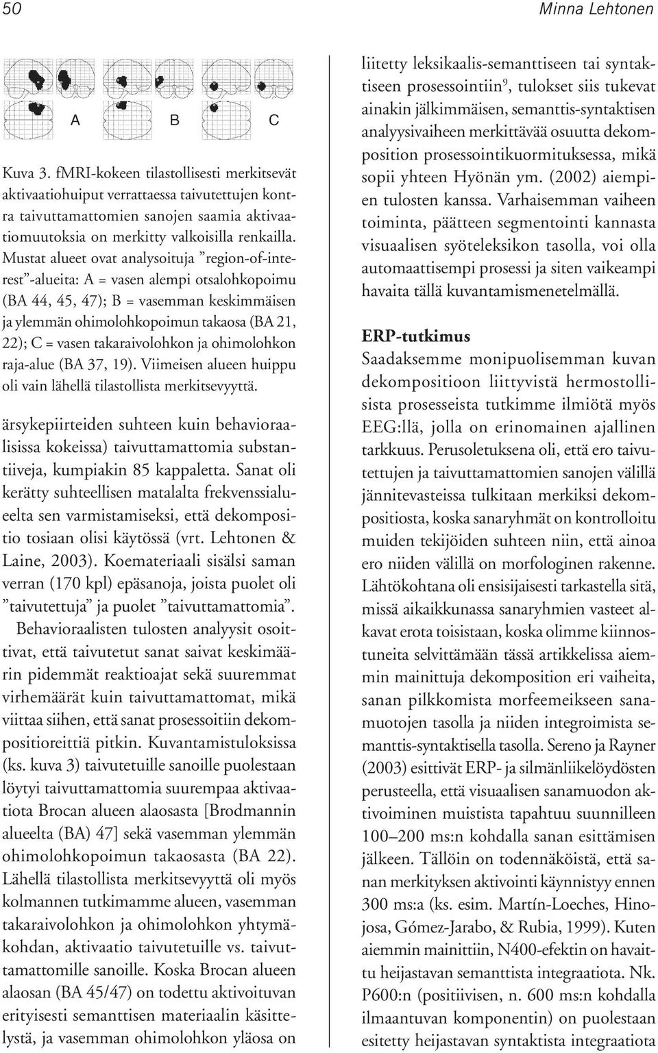 Mustat alueet ovat analysoituja region-of-interest -alueita: A = vasen alempi otsalohkopoimu (BA 44, 45, 47); B = vasemman keskimmäisen ja ylemmän ohimolohkopoimun takaosa (BA 21, 22); C = vasen