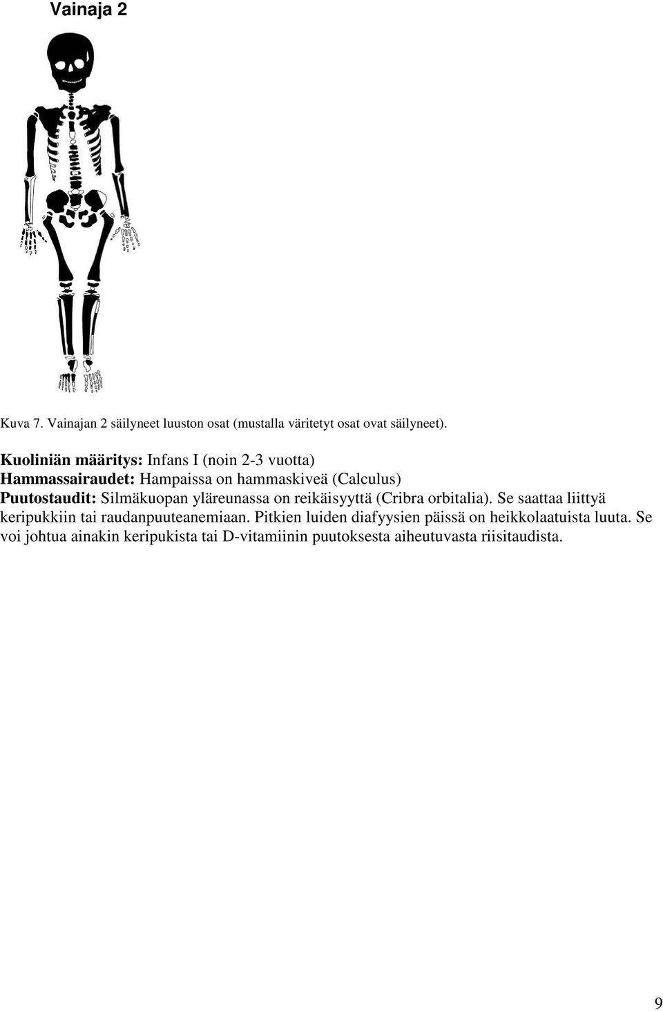 Silmäkuopan yläreunassa on reikäisyyttä (Cribra orbitalia). Se saattaa liittyä keripukkiin tai raudanpuuteanemiaan.