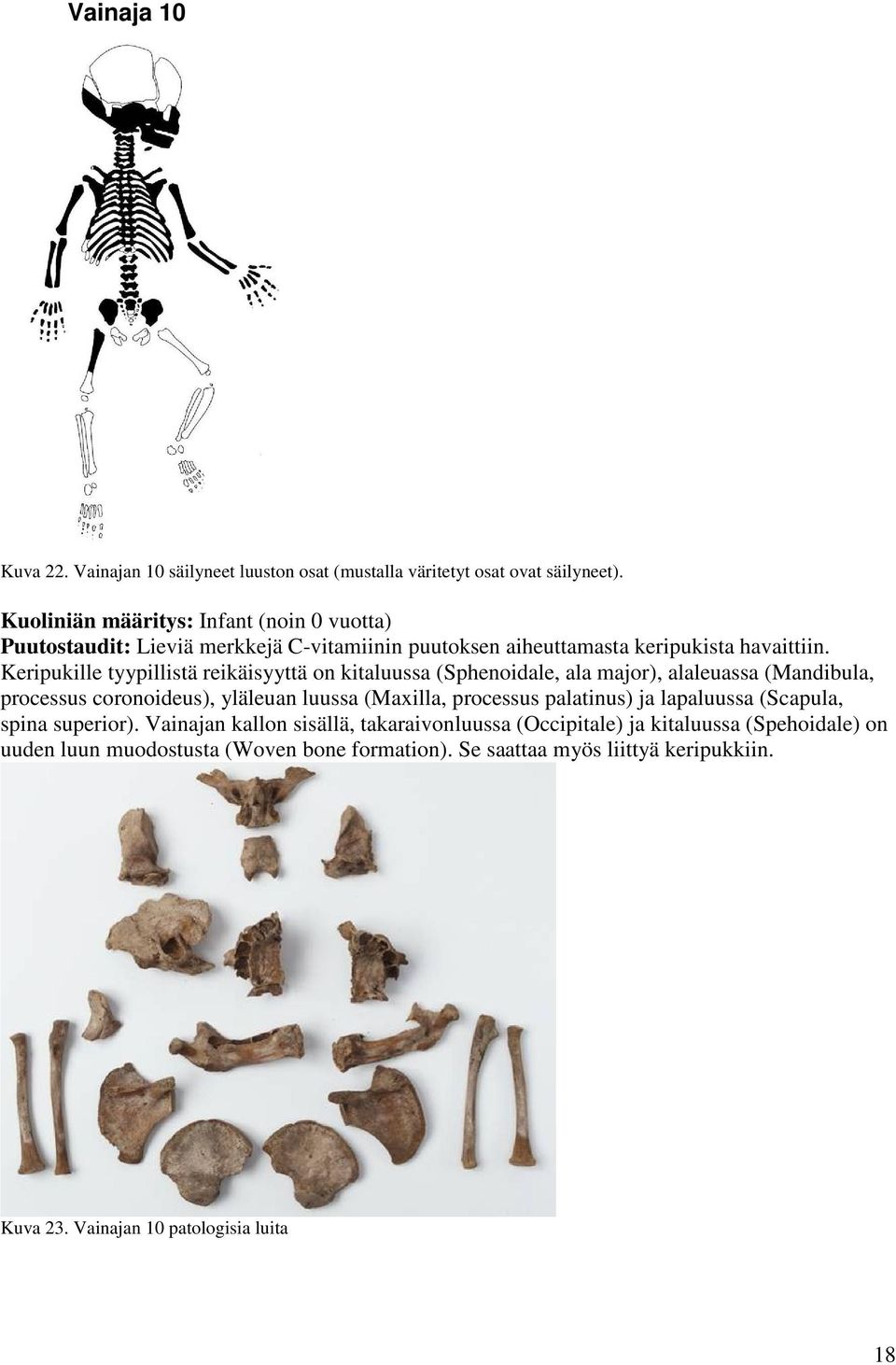 Keripukille tyypillistä reikäisyyttä on kitaluussa (Sphenoidale, ala major), alaleuassa (Mandibula, processus coronoideus), yläleuan luussa (Mailla, processus