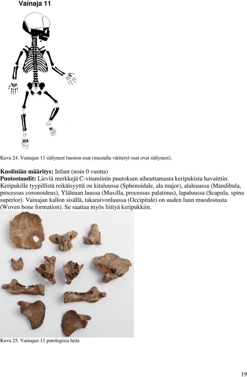 Keripukille tyypillistä reikäisyyttä on kitaluussa (Sphenoidale, ala major), alaleuassa (Mandibula, processus coronoideus), Yläleuan luussa (Mailla,