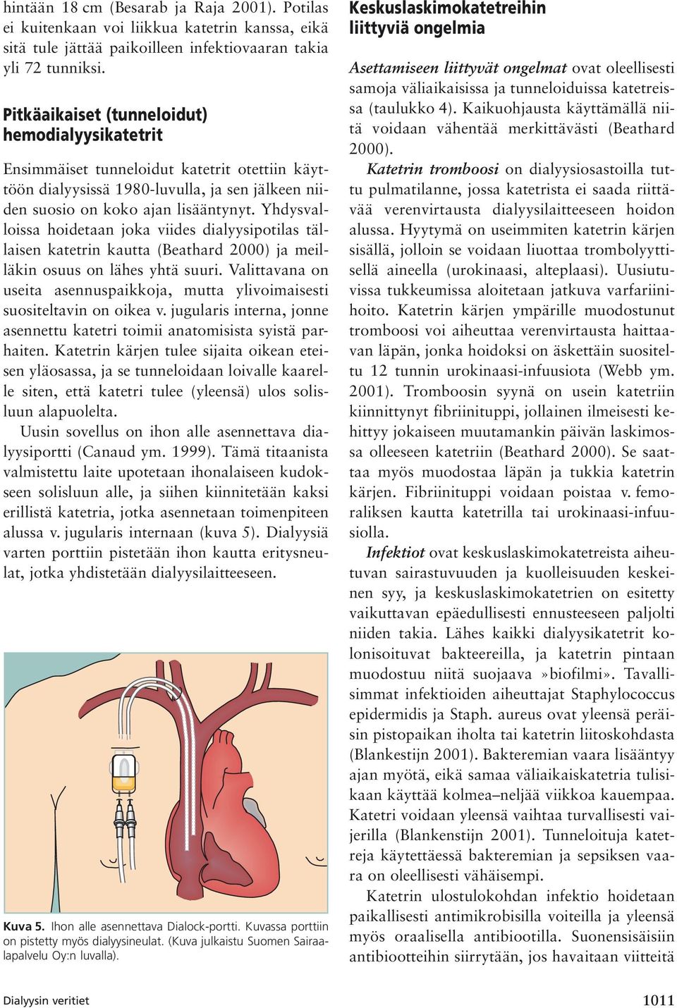 Yhdysvalloissa hoidetaan joka viides dialyysipotilas tällaisen katetrin kautta (Beathard 2000) ja meilläkin osuus on lähes yhtä suuri.