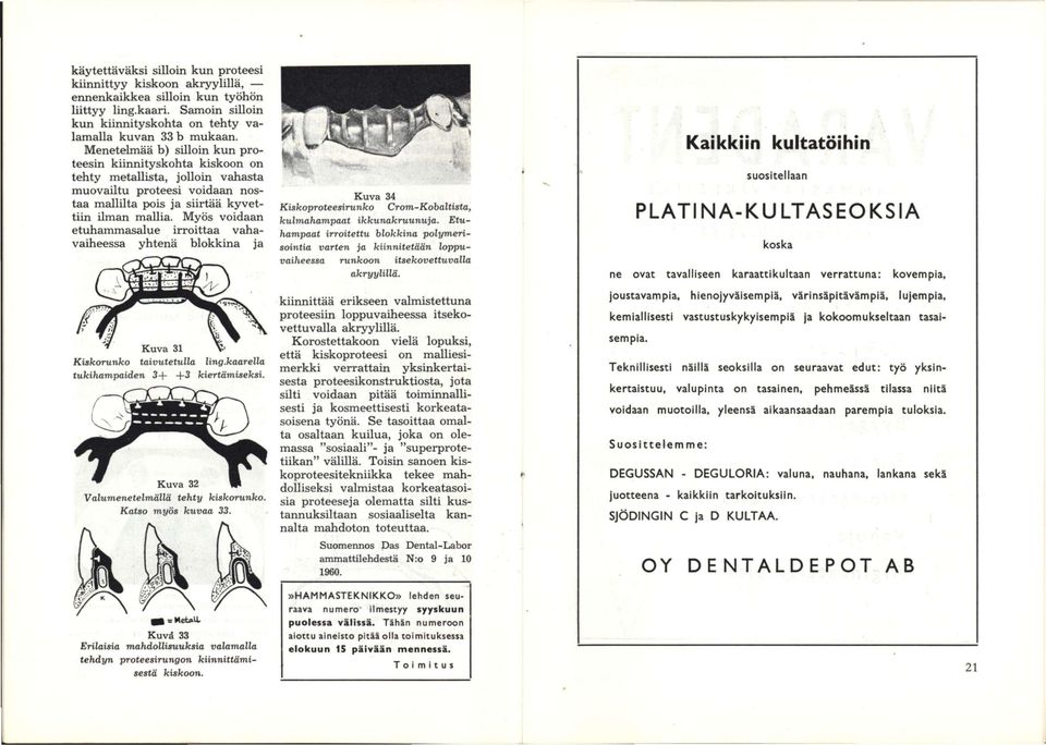 Myös voidaan etuhammasalue irroittaa vahavaiheessa yhtenä blokkina ja Kiskorunko taivutetulla ling.kaarella tukihampaiden 3+ +3 kiertämiseksi.