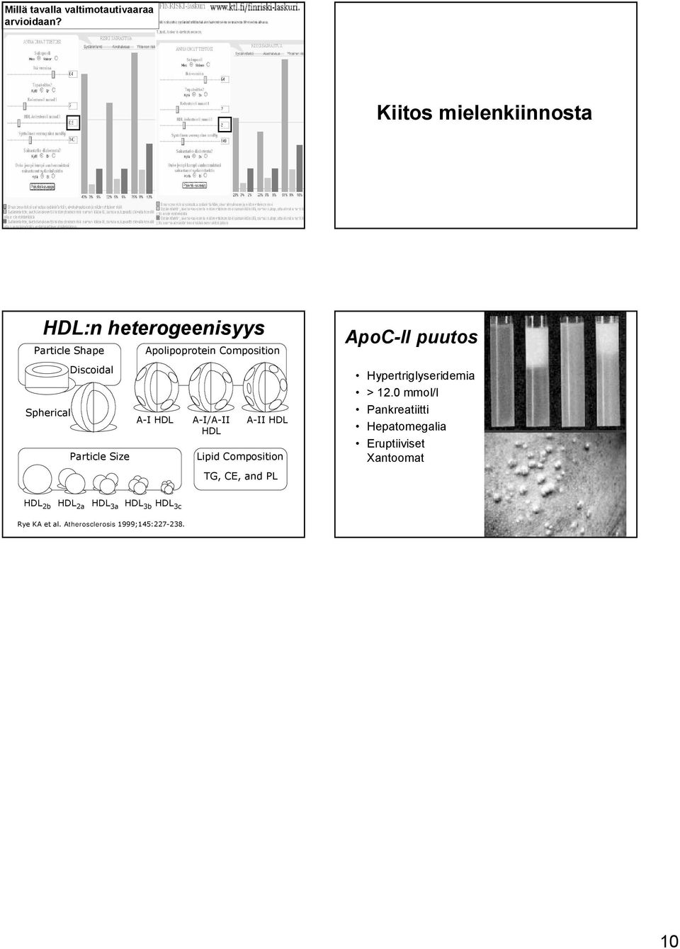 Discoidal Hypertriglyseridemia > 12.