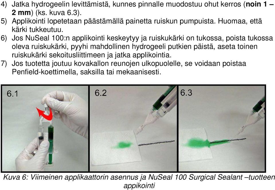 6) Jos NuSeal 100:n applikointi keskeytyy ja ruiskukärki on tukossa, poista tukossa oleva ruiskukärki, pyyhi mahdollinen hydrogeeli putkien päistä, aseta