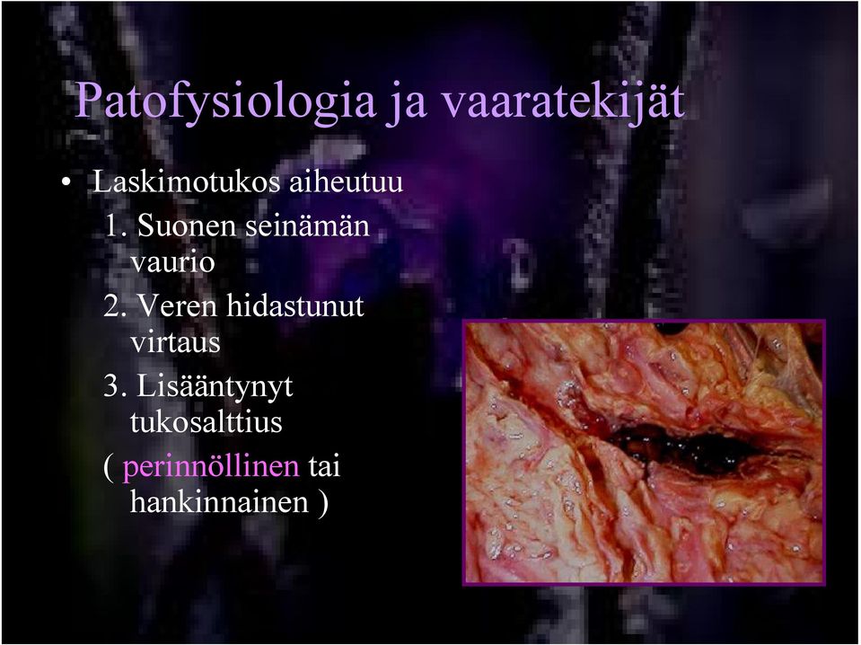 Suonen seinämän vaurio 2.
