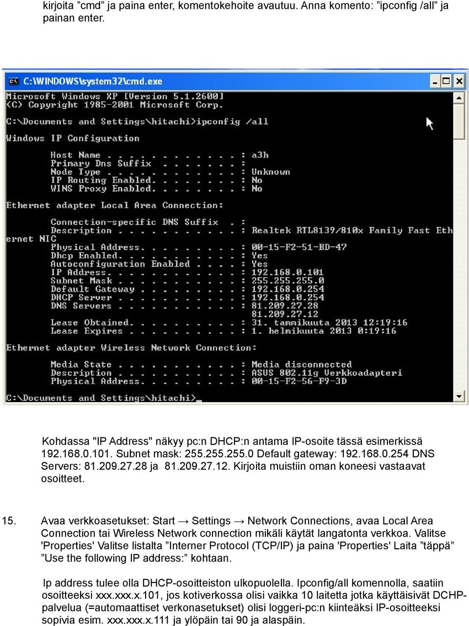 Avaa verkkoasetukset: Start Settings Network Connections, avaa Local Area Connection tai Wireless Network connection mikäli käytät langatonta verkkoa.