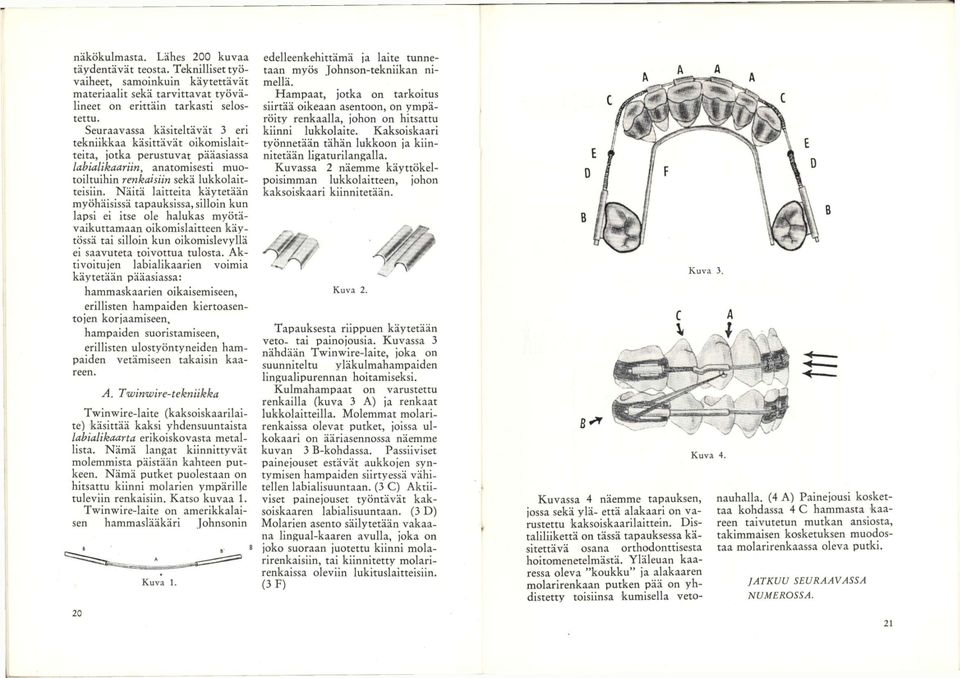 Näitä laitteita käytetään myöhäisissä tapauksissa, silloin kun lapsi ei itse ole halukas myötävaikuttamaan oikomislaitteen käytössä tai silloin kun oikomislevyllä ei saavuteta toivottua tulosta.