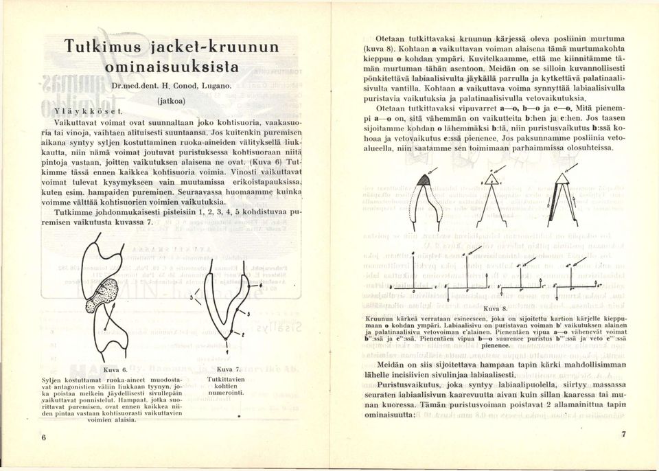 Jos kuitenkin puremisen aikana syntyy syljen kostuttaminen ruoka-aineiden välityksellä liukkautta, niin nämä voimat joutuvat puristuksessa kohtisuoraan niitä, pintoja vastaan, joitten vaikutuksen