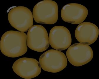 Patologinen tilanne Trigly FFA - X Insulin Hormonisensitiivinen lipaasi Lipolyysi KoentsyymiA b-oxidation FFA Asetyyli-CoA