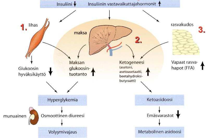 DKA patofysiologia