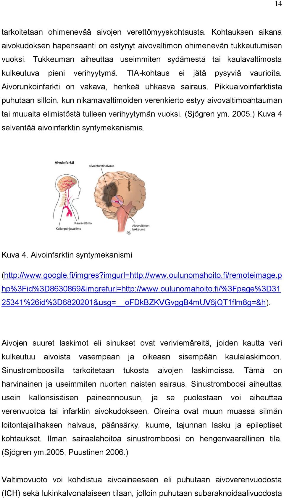 Pikkuaivoinfarktista puhutaan silloin, kun nikamavaltimoiden verenkierto estyy aivovaltimoahtauman tai muualta elimistöstä tulleen verihyytymän vuoksi. (Sjögren ym. 2005.