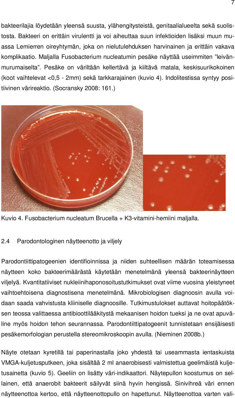 Maljalla Fusobacterium nucleatumin pesäke näyttää useimmiten leivänmurumaiselta.