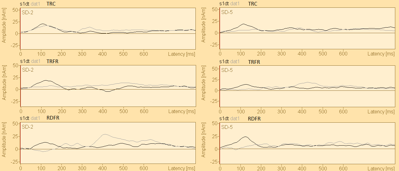 Kuva 8. Lyhyiden ärsykkeiden s1dt (standardi-/ata/) ja dat1 (poikkeava /ata/) tangentiaalisten lähdepaikkaaaltojen vertailut ryhmittäin.