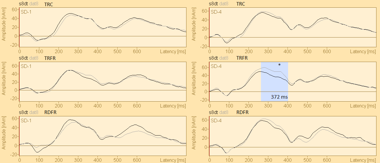 Kuva 10. Pitkien ärsykkeiden s8dt (standardi-/atta/) ja dat8 (poikkeava /atta/) tangentiaalisten lähdepaikka-aaltojen vertailut ryhmittäin.