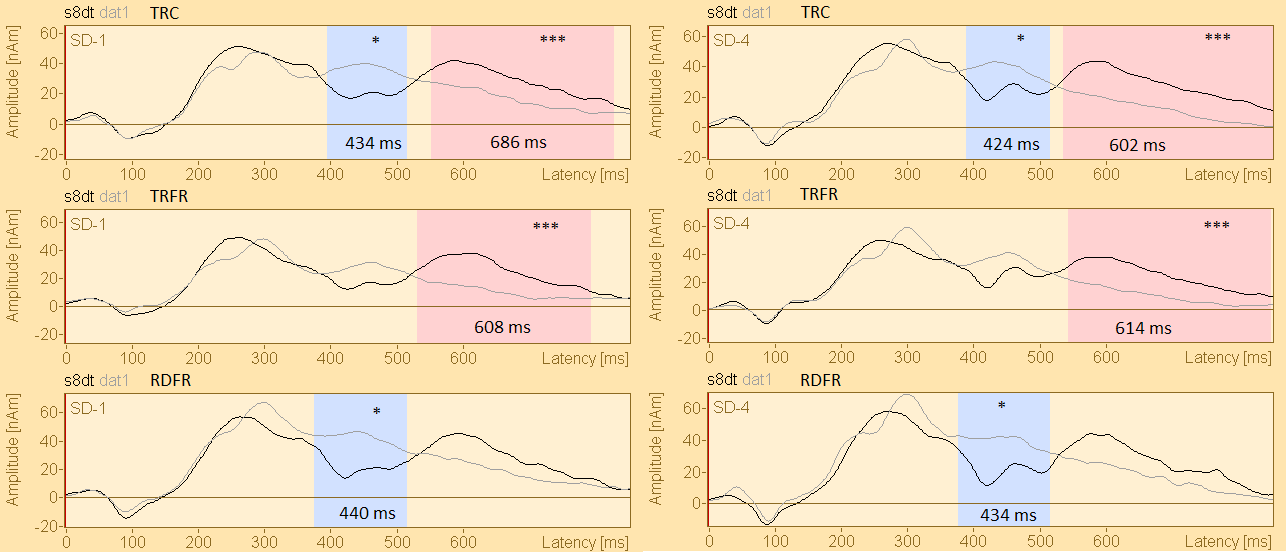 Kuva 14. Standardiärsykkeen s8dt (standardi-/atta/) ja poikkeavan ärsykkeen dat1 (poikkeava-/ata/) tangentiaalisten lähdepaikka-aaltojen vertailut ryhmittäin.