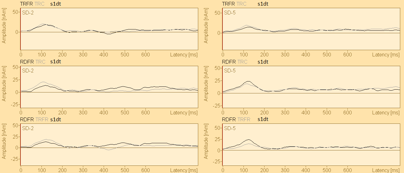 Kuva 16. Standardiärsykkeen s1dt (standardi-/ata/) tangentiaalisten lähdepaikka-aaltojen vertailut ryhmien välillä.