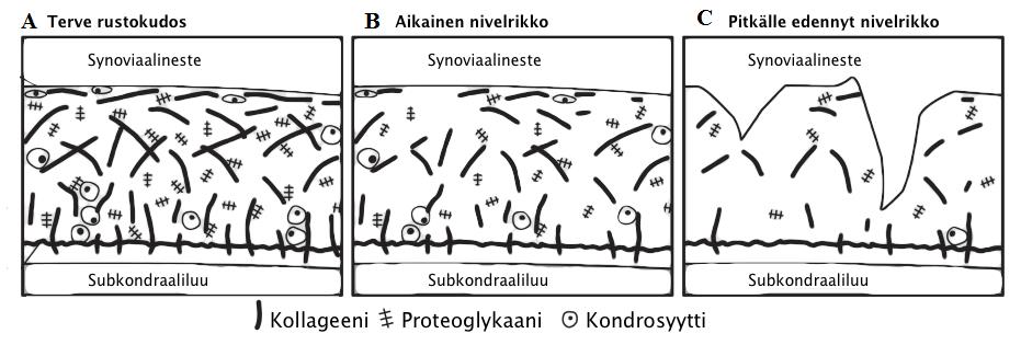 dusoireiden ja sairauden aktivaatiotason yhteyttä sairauden etenemiselle.