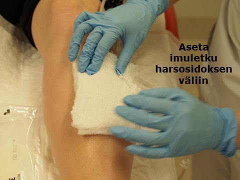 45 Imuletkun asettaminen harsosidoksen