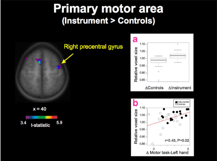 Music as a hobby will change the brain n Children s brain change after 15 months of piano training n More gray matter in auditory and motor areas as well as thicker corpus callosum n Practicing makes