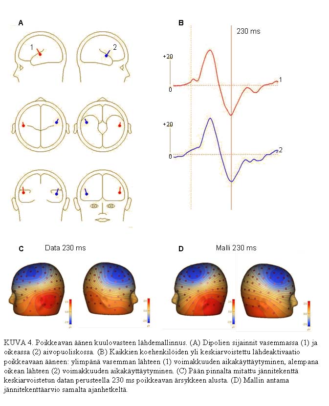 17 Lähdeanalyysin pohjalta katsottuna neljällä lapsella MMN:n latenssi oli hyvin myöhäinen, noin 300 ms ja ylikin, ja yhdellä lapsella oli oikealla puolella hyvin suuri negatiivinen arvo
