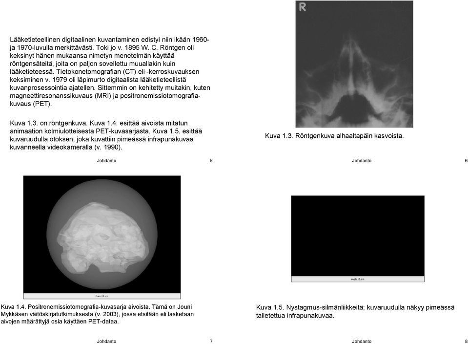 1979 oli läpimurto digitaalista lääketieteellistä kuvanprosessointia ajatellen. Sittemmin on kehitetty muitakin, kuten magneettiresonanssikuvaus (MRI) ja positronemissiotomografiakuvaus (PET). Kuva 1.