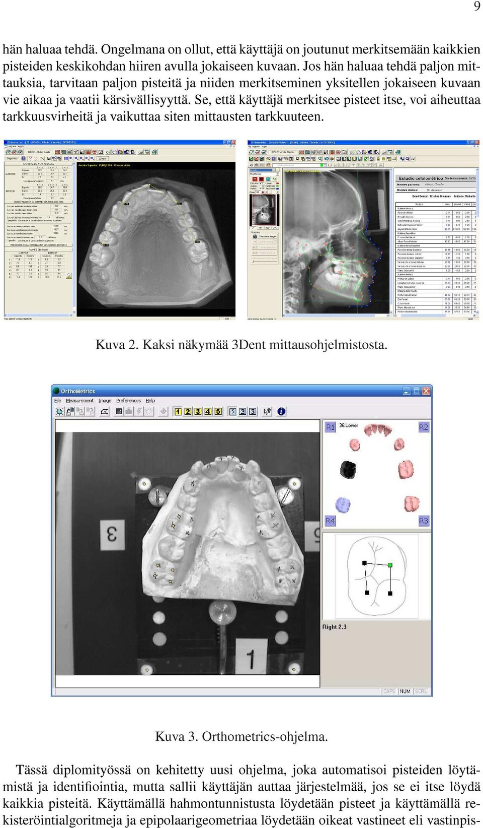 Se, että käyttäjä merkitsee pisteet itse, voi aiheuttaa tarkkuusvirheitä ja vaikuttaa siten mittausten tarkkuuteen. 9 Kuva 2. Kaksi näkymää 3Dent mittausohjelmistosta. Kuva 3. Orthometrics-ohjelma.