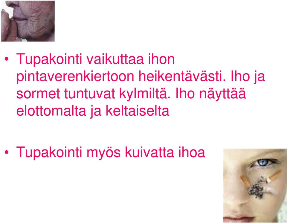 Iho ja sormet tuntuvat kylmiltä.