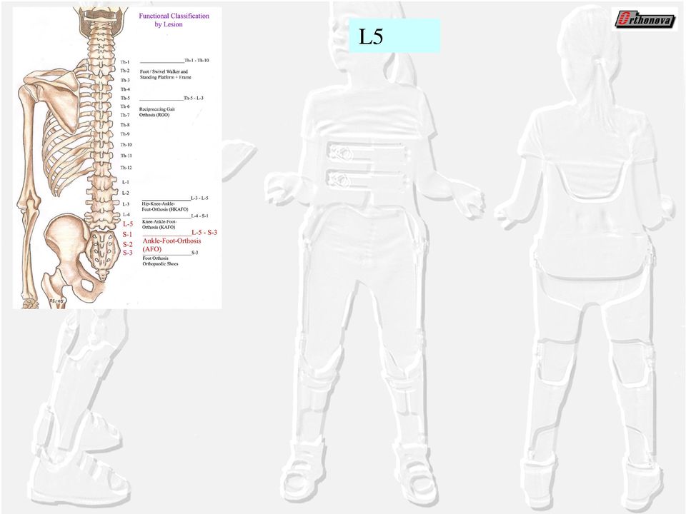 + fleksorit supistuvat yhtä aikaa > vaikea nostaa lantio ja heilauttaa alaraaja eteenpäin Kompensaatio: frontaali heilahdus + rotaatio + alaraajan heilautus eteenpäin