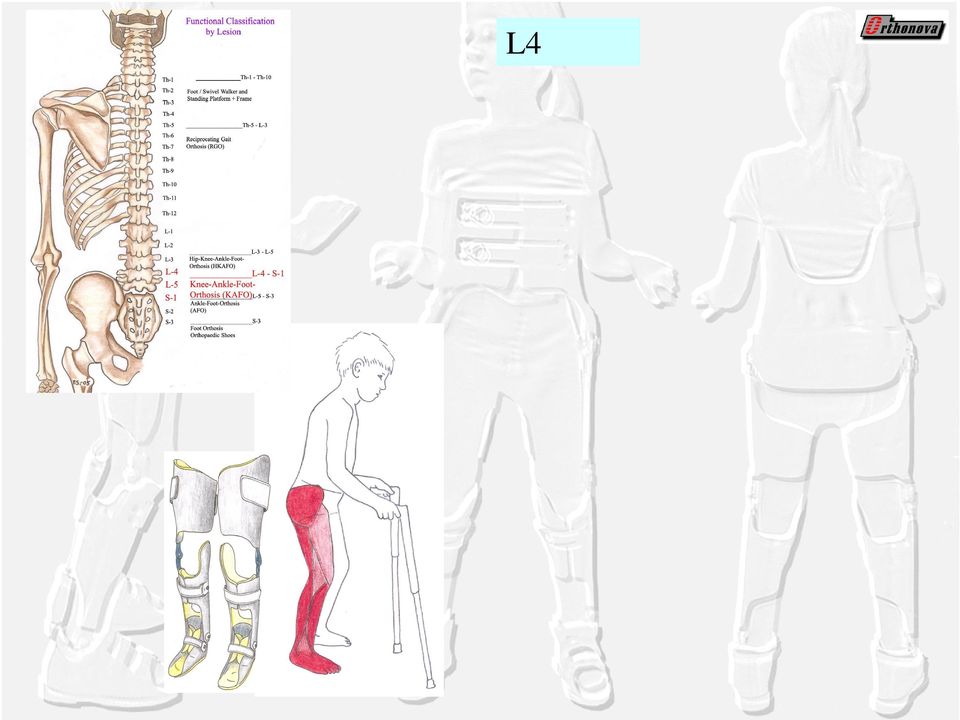 lumborum: kontrolateraalinen heilautus + lantion nosto Toimintavajaat adduktorit: auttaa frontaali heilahdusta Tukijalan rotaatio, hitauden laki (<paino) Deformiteetit: Synnynnäinen: lantion