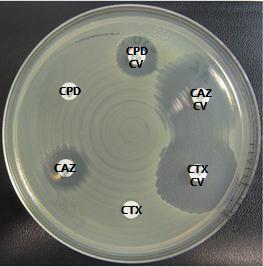 13 Kuvio 4. Esimerkki ESBL-kannan herkkyyksistä kefpodoksiimille (CPD), keftatsidiimille (CAZ) ja kefotaksiimille (CTX) sekä niiden klavulaanihappoyhdistelmille (CV).
