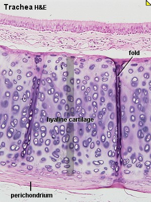 Ruston kasvu 1. nuoressa rustossa kondrosyytit tuottavat väliainetta ympärilleen interstitiaalinen eli endogeeninen kasvu 2.