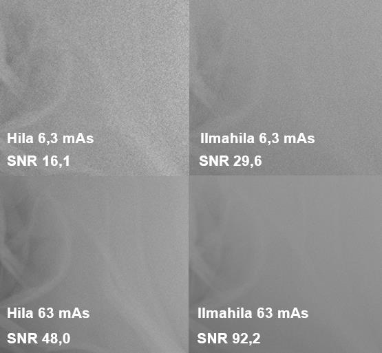 31 kuvissa lantion alueen luut olivat paremmin erotettavissa kuin ilmahilan kuvissa vaikka ilmahilan SNR-arvot olivatkin lantion alueella keskimäärin 80,7 % paremmat.