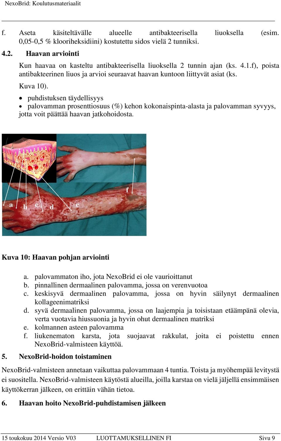 Kuva 10). puhdistuksen täydellisyys palovamman prosenttiosuus (%) kehon kokonaispinta-alasta ja palovamman syvyys, jotta voit päättää haavan jatkohoidosta.