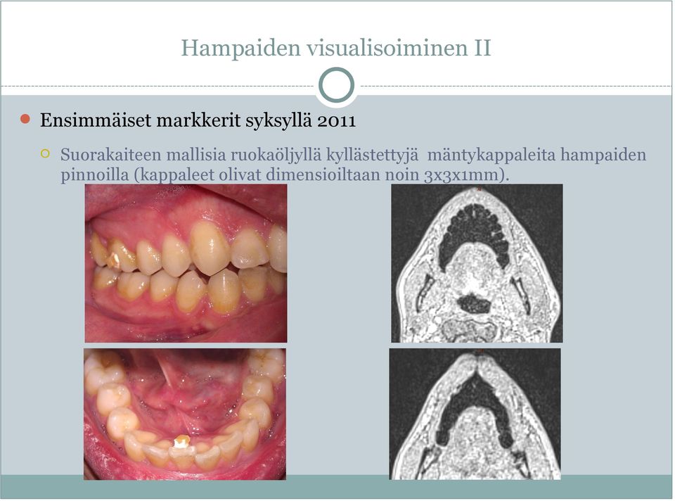 ruokaöljyllä kyllästettyjä mäntykappaleita