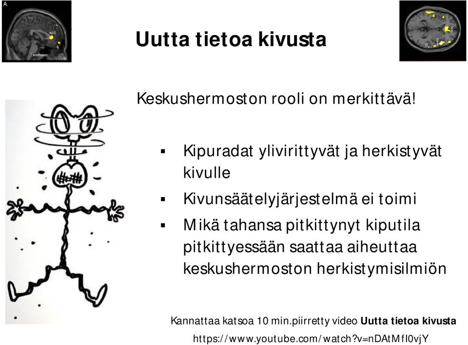 tahansa pitkittynyt kiputila pitkittyessään saattaa aiheuttaa keskushermoston