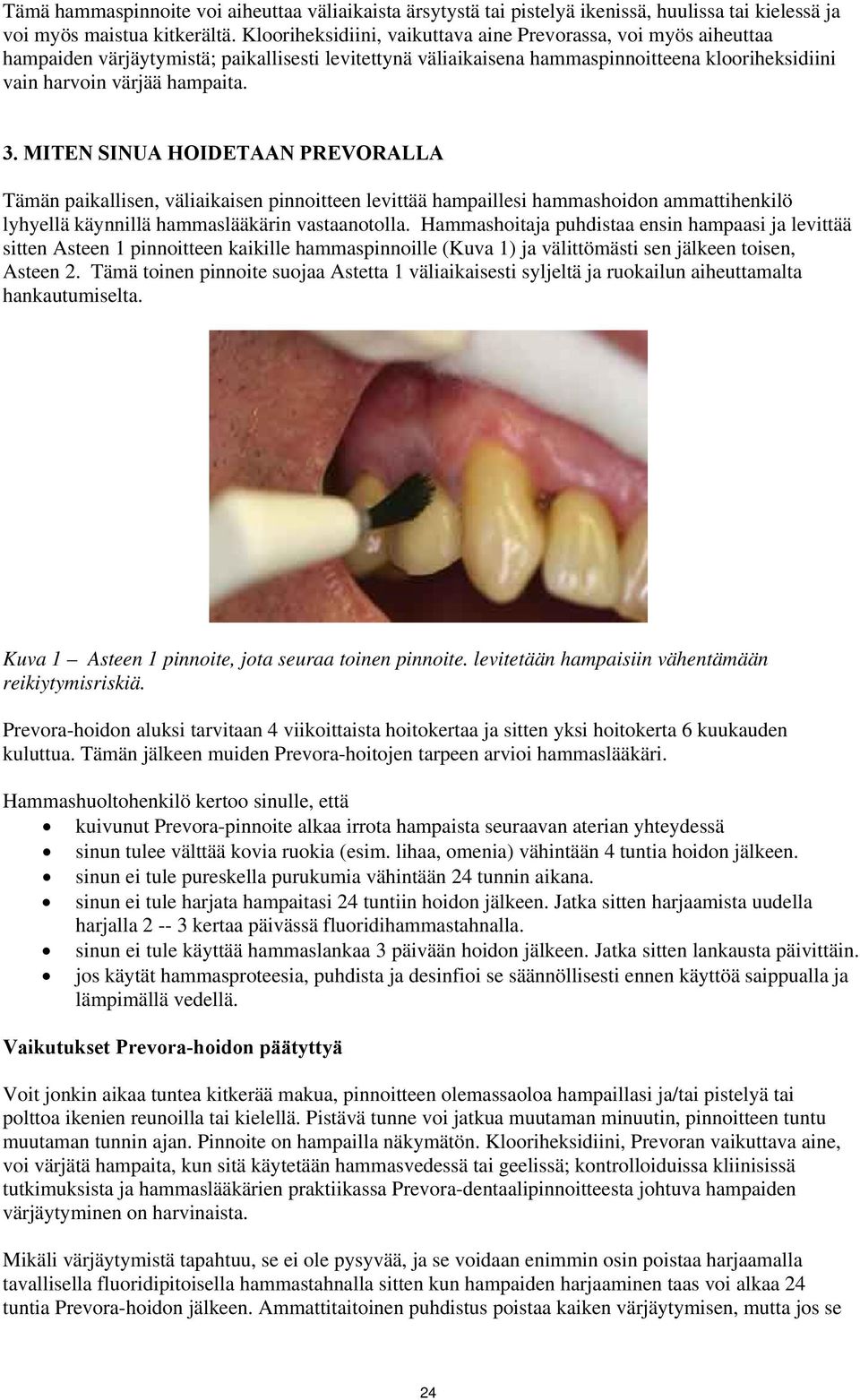 MITEN SINUA HOIDETAAN PREVORALLA Tämän paikallisen, väliaikaisen pinnoitteen levittää hampaillesi hammashoidon ammattihenkilö lyhyellä käynnillä hammaslääkärin vastaanotolla.