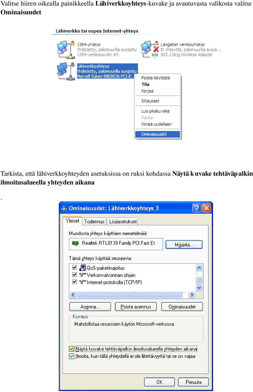 Tarkista, että lähiverkkoyhteyden asetuksissa on ruksi