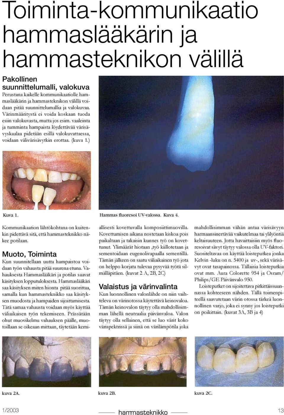 vaaleinta ja tumminta hampaista löydettävää värisävyskaalaa pidetään esillä valokuvattaessa, voidaan välivärisävytkin erottaa. (kuva 1.) Kuva 1.
