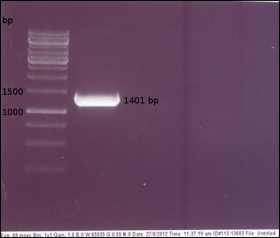 22 tämän kannan genomisekvenssi ei ehtinyt valmistua työn suoritusaikana. Taulukkoon 12 on koottu eri slp-geenien PCR-tuotteiden DNA-saantoja ja kokoja. Taulukko 12. L.