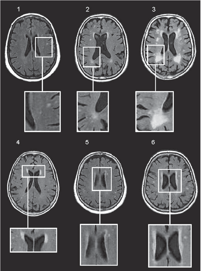 Cavalieri M, Schmidt H, Schmidt R.