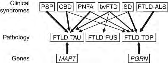 Frontotemporal lobe degeneration Fig. 1 Clinical, pathological and genetic spectrum of frontotemporal lobar degeneration (FTLD).