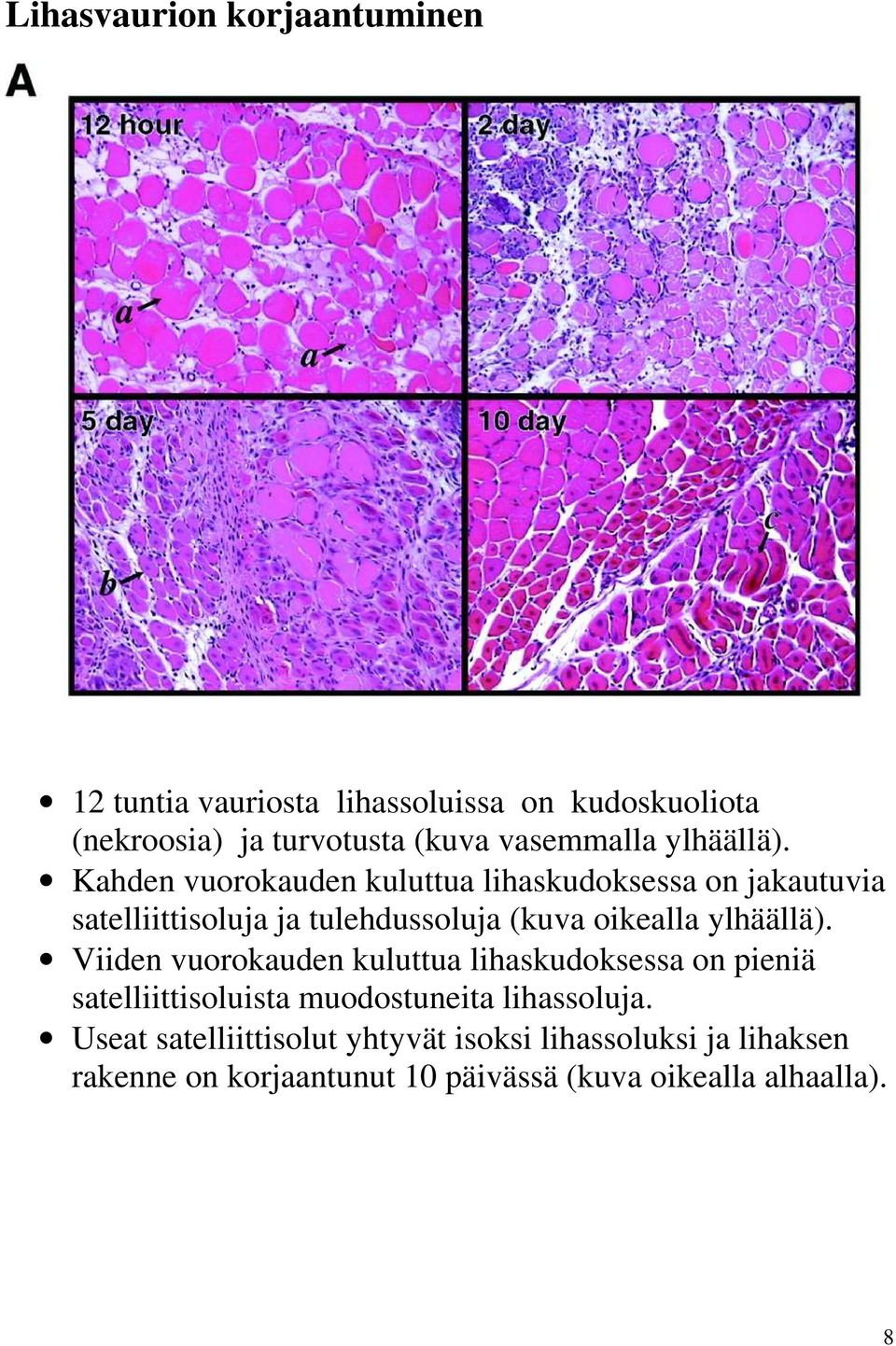 Kahden vuorokauden kuluttua lihaskudoksessa on jakautuvia satelliittisoluja ja tulehdussoluja (kuva oikealla ylhäällä).